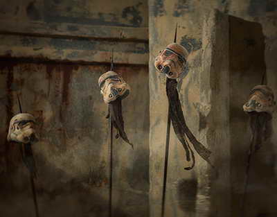 МРТ гипофиза: функции, патологии и диагностика